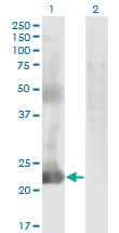 Monoclonal Mouse anti-Human CCDC115 Antibody (clone 4E9, IHC, WB)