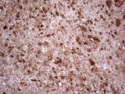 RHOC Antibody (C-Terminus, clone OTI3A5)