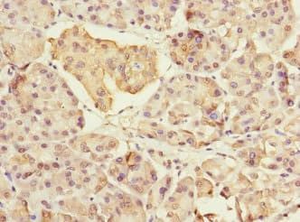 Polyclonal Rabbit anti-Human MYL7 Antibody (IHC, WB)