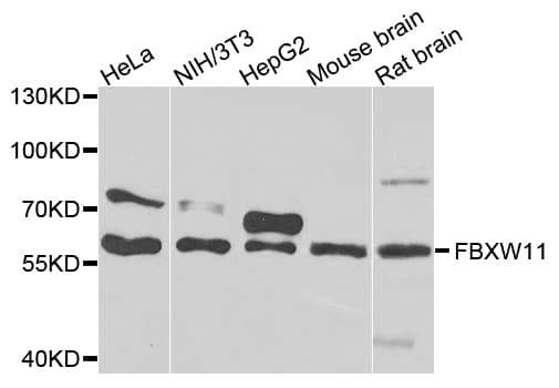 Polyclonal Rabbit anti-Human FBXW11 Antibody (IHC, IF, WB)