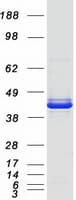 Human SERPINB3 Protein (Recombinant Myc-DDK (Flag))