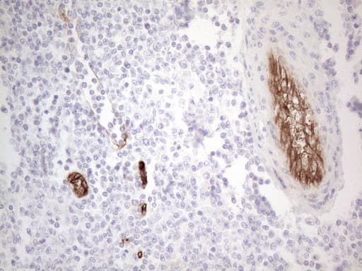 CD34 Antibody (aa312-385, clone OTI11A5)