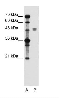 SLC39A6 / LIV-1 Antibody (aa26-75)
