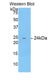 CTSB / Cathepsin B Antibody (aa129-333)
