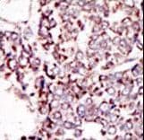 TYRO3 Antibody (aa842-873)