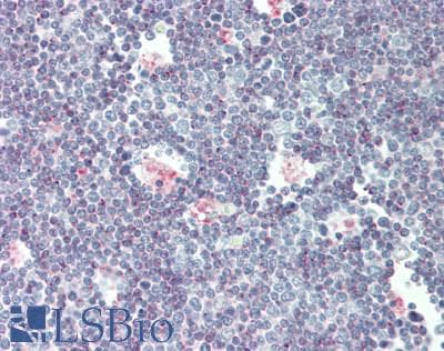IHC-plus™ Polyclonal Rabbit anti-Human CD1D Antibody (Internal, IHC, WB)