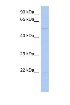 RIPK3 / RIP3 Antibody (aa251-300)
