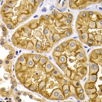 Polyclonal Rabbit anti-Human KRT5 / CK5 / Cytokeratin 5 Antibody (IHC, IF, WB)