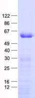 Human IP6K2 Protein (Recombinant His, N-Terminal)