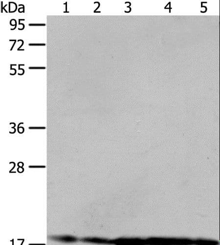 Polyclonal Rabbit anti-Human ARF6 Antibody (IHC, WB)