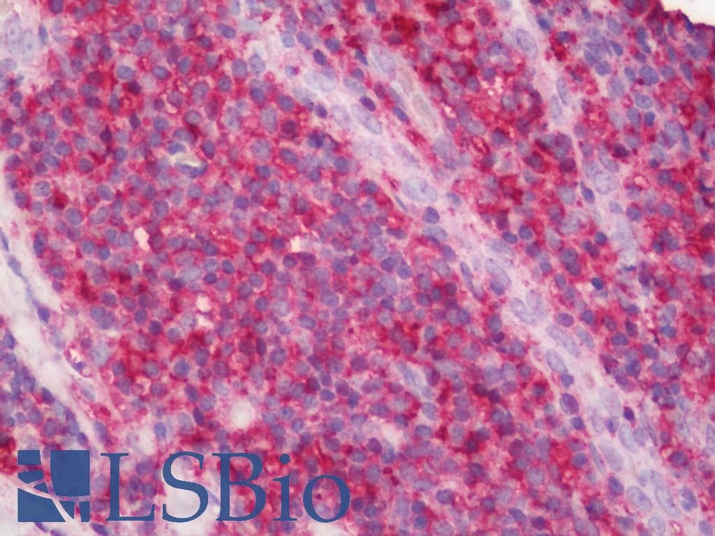 IHC-plus™ Polyclonal Rabbit anti-Human CD44 Antibody (aa692-742, IHC, WB)