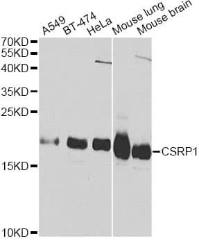 Polyclonal Rabbit anti-Human CSRP1 Antibody (IHC, IF, WB)