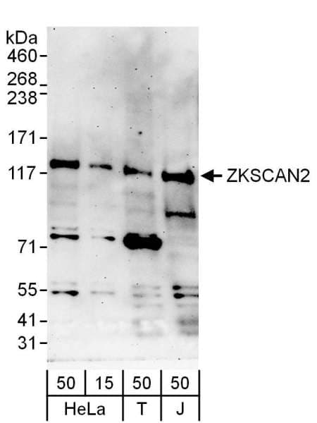 ZKSCAN2 Antibody (aa917-967)