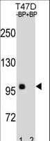 CTNNB1 / Beta Catenin Antibody (aa692-721)