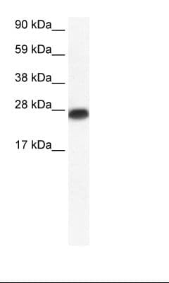 MYF6 / MRF4 Antibody (aa66-115)