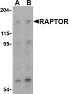 IHC-plus™ Raptor / Mip1 Antibody