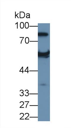 Antithrombin Antibody (aa1-259, PE)