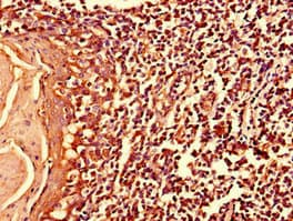 Polyclonal Rabbit anti-Human MYO10 / Myosin-X Antibody (IHC, IF)