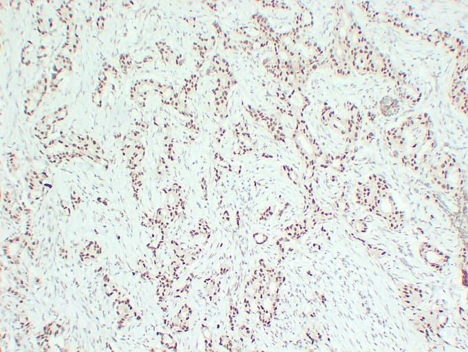 ER Alpha / Estrogen Receptor Antibody (clone ABT-ER)