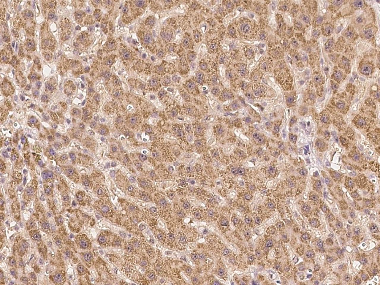 KIAA1530 Antibody