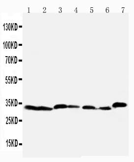 CASP6 / Caspase 6 Antibody (aa7-27)