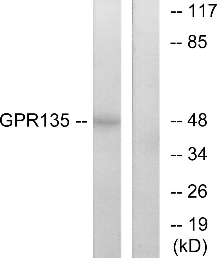GPR135 Antibody (aa371-420)