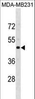 Polyclonal Rabbit anti-Human CCR5 Antibody (aa151-177, WB)