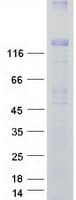 Human TRPM4 Protein (Recombinant Myc-DDK (Flag))