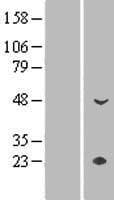 CYP4Z1 Protein (Over-Expression Lysate Myc-DDK (Flag))