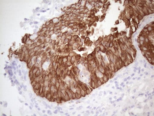 KRT16 / CK16 / Cytokeratin 16 Antibody (clone OTI2H8)