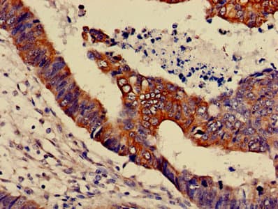 Polyclonal Rabbit anti-Human MAPK3 / ERK1 Antibody (IHC, WB)