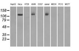 BUB1B / BubR1 Antibody (clone OTI3D9)