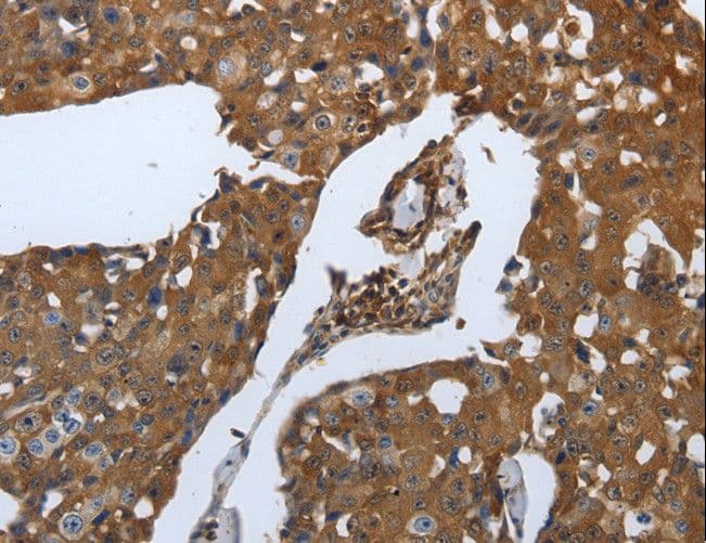IHC-plus™ SLC34A2 / NaPi-2b Antibody (C-Terminus)