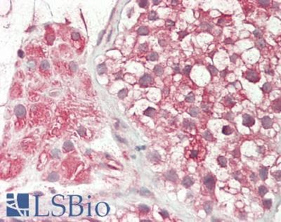 IHC-plus™ PCDHA3 Antibody (aa773-800)