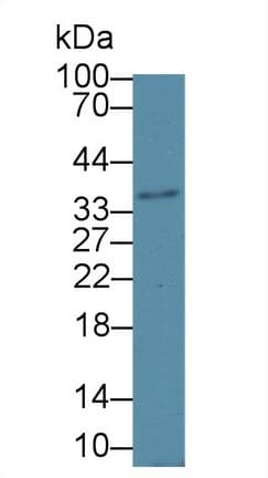 HSD17B12 Antibody (aa1-312, APC)