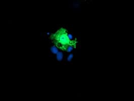 KIF2C / MCAK Antibody (clone OTI1C5)