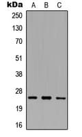 IHC-plus™ SRA1 / SRA Antibody (Internal)