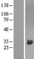 Human ULBP2 / RAET1H Protein (Over-Expression Lysate Myc-DDK (Flag))