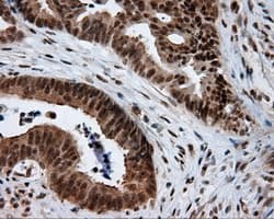 NPR3 Antibody (clone OTI4C3)