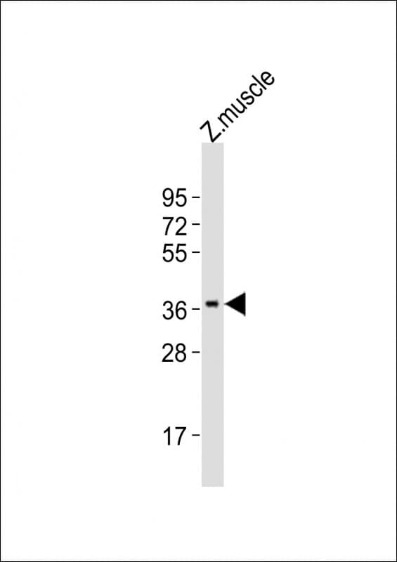 MC4R / Melanocortin 4 Receptor Antibody (aa25-57)