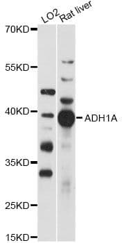 ADH1A / Alcohol Dehydrogenase Antibody