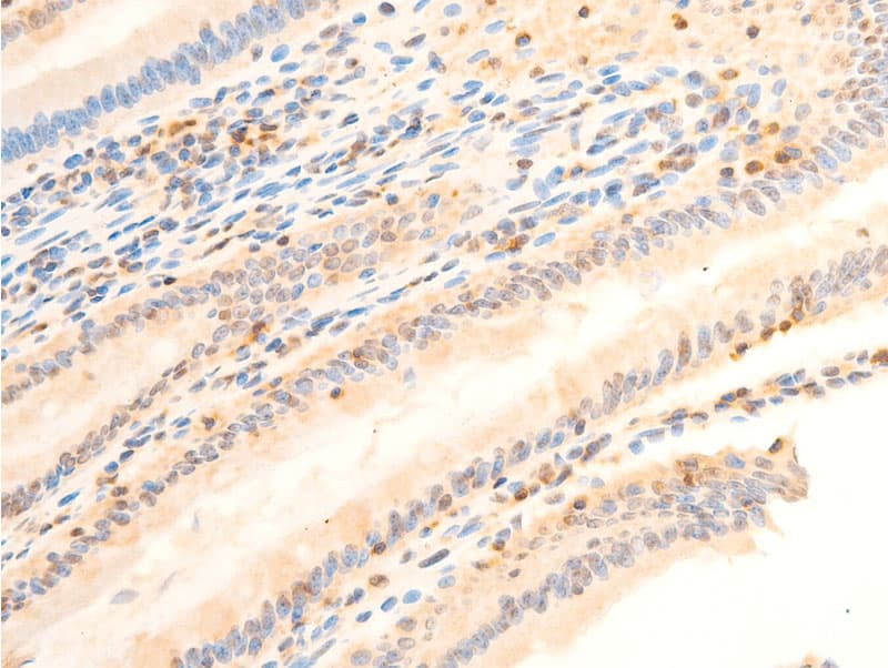 PDPK1 / PDK1 Antibody (phospho-Ser241)