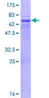Human UEVLD Protein (Recombinant GST)