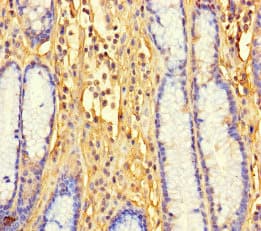 Polyclonal Rabbit anti-Human LTV1 Antibody