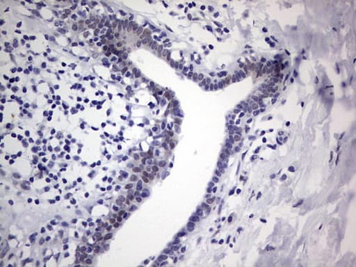 Monoclonal Mouse anti-Human RAD23B / HR23B Antibody (clone OTI7G10, aa1-253, IHC, WB)