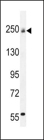 Polyclonal Rabbit anti-Human COL5A1 / Collagen V Alpha 1 Antibody (aa54-82, IHC, WB)