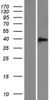 ZFAND3 / TEX27 Protein (Over-Expression Lysate Myc-DDK (Flag))