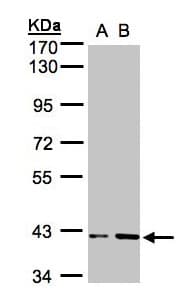 IHC-plus™ PRPSAP1 Antibody (aa1-356)