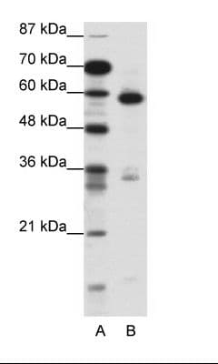MBD1 Antibody (C-Terminus)