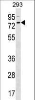 Polyclonal Rabbit anti-Human ZNF416 Antibody (aa556-582, WB)